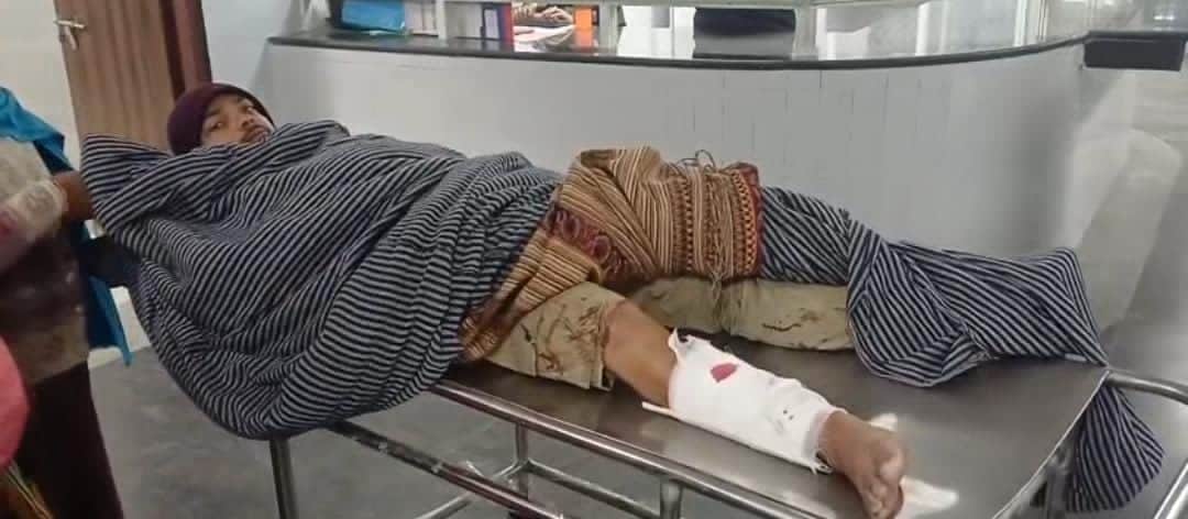 घायल युवक का उपचार जारी।