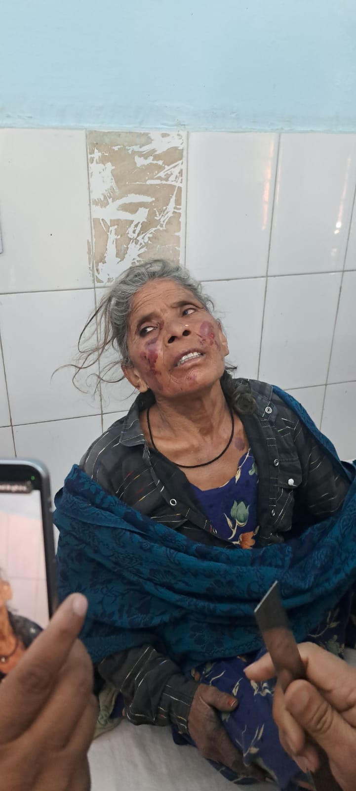 Woman going to peel sugarcane beaten up