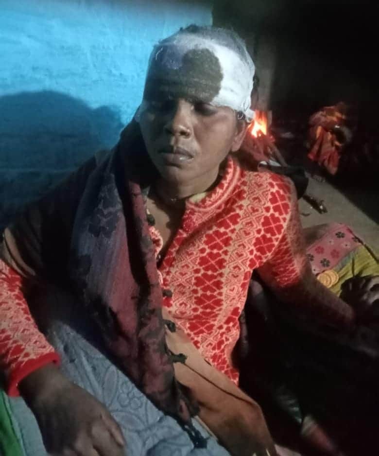 फोटो -20 घायल राजेश्वरी।