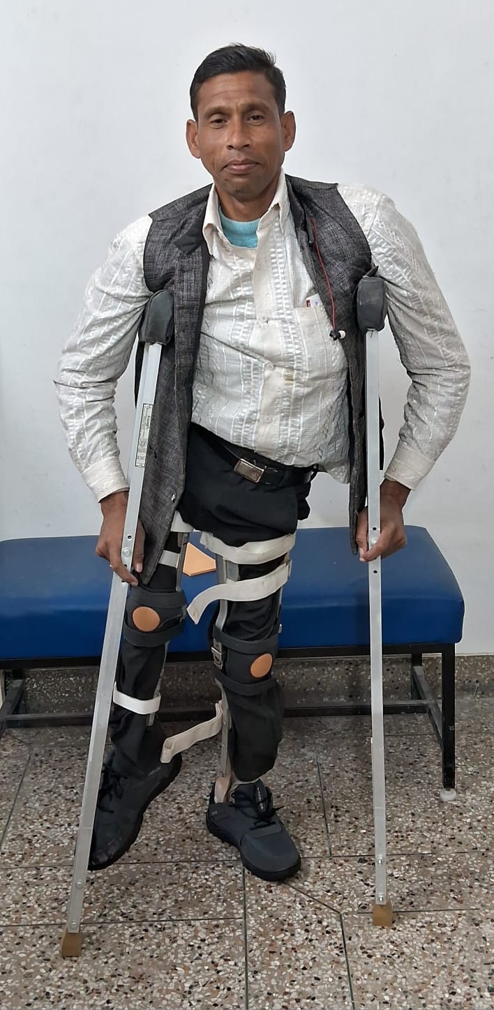 Disabled person started walking with artificial leg, 10 were examined