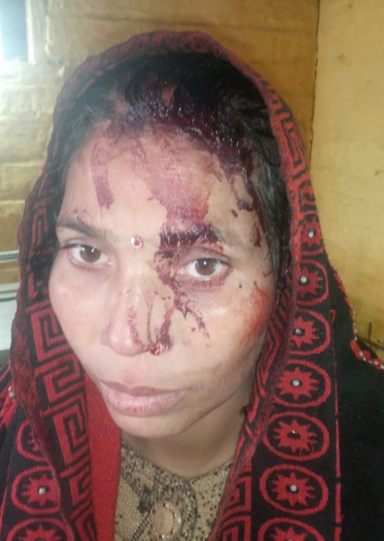 Woman beaten up by people from another community, injured