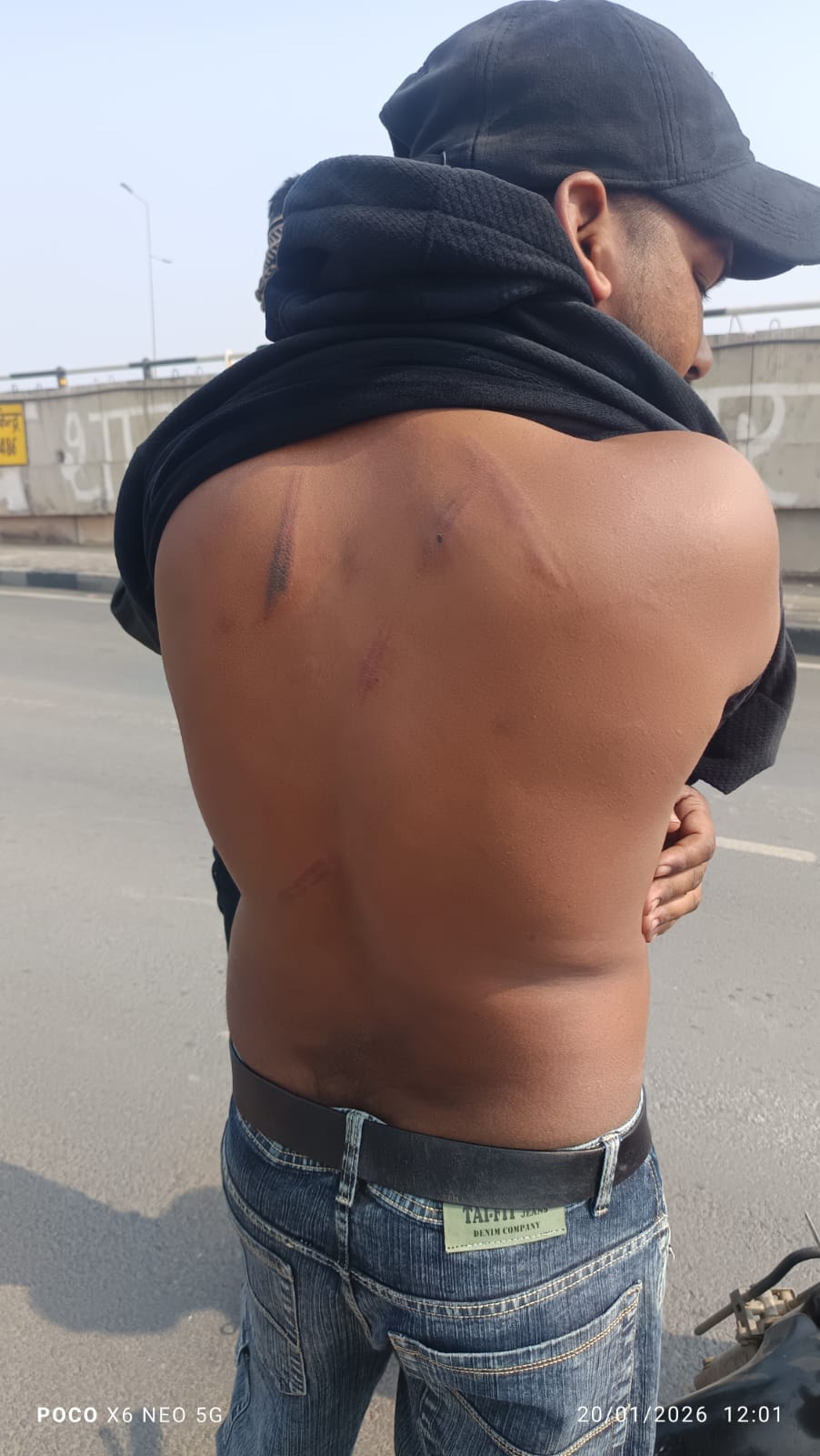 Complaint of beating a youth