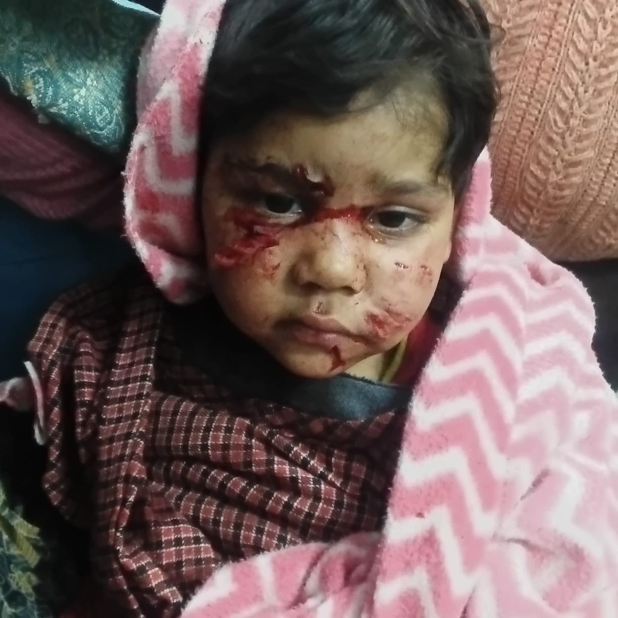 A four-year-old girl standing outside her house was attacked by a jackal and injured.