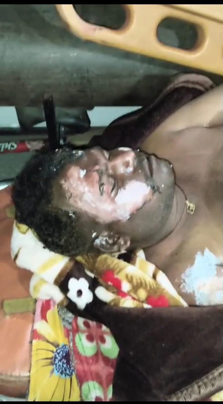 Petrol Stoica Scientist Fire in No Credit Delivery Shop... Leading Burnt, Serious