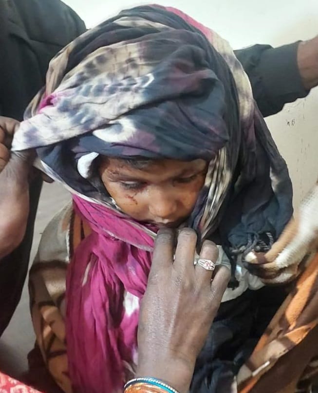Leopard entered the hut by tearing sackcloth, attacked and injured an innocent child sleeping near her mother