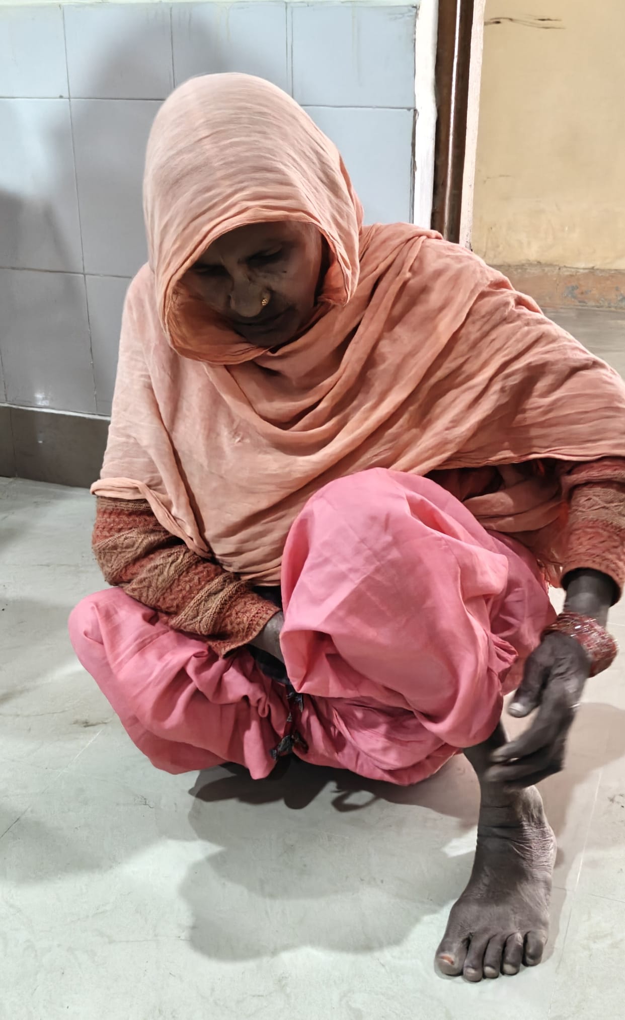 Disabled people faced problems in the camp