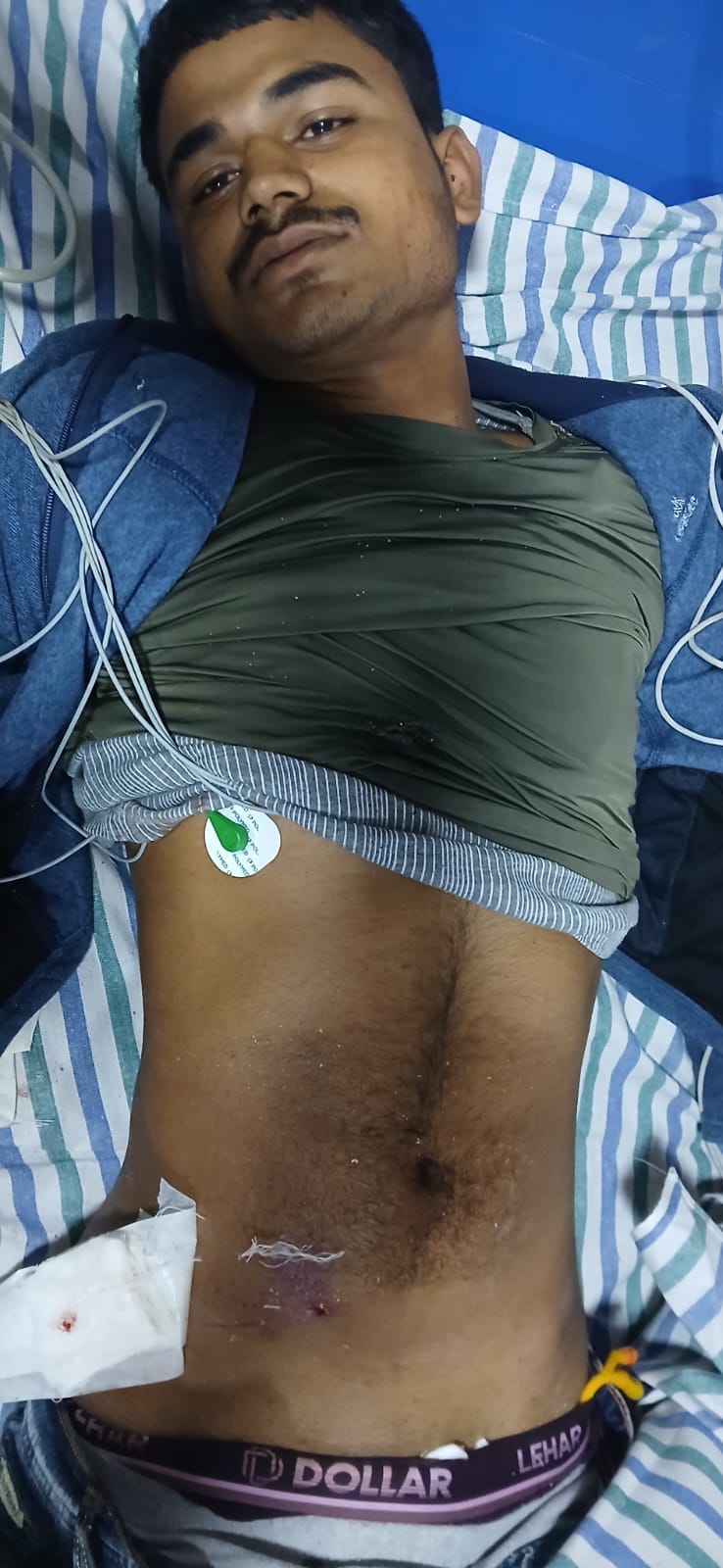 Young man injured after being shot in the stomach