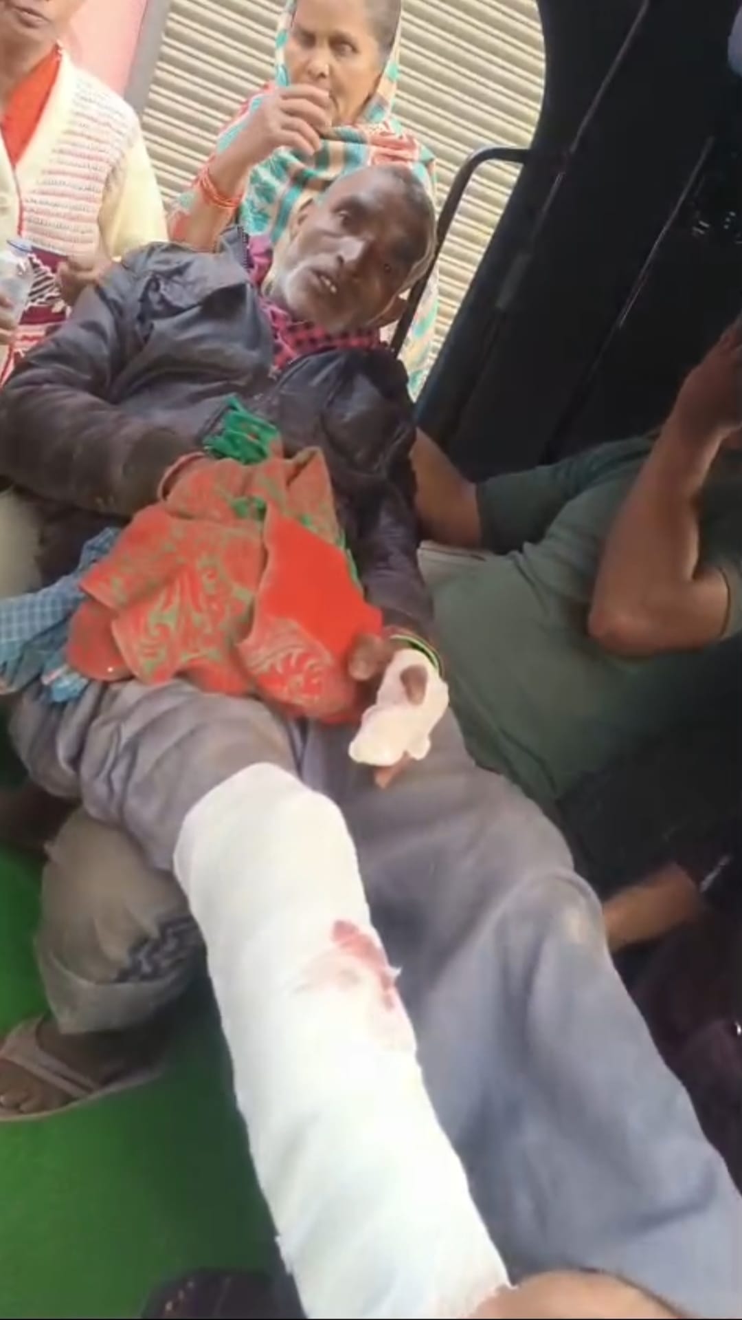 Handicapped man attacked with a stick, fingers and feet injured