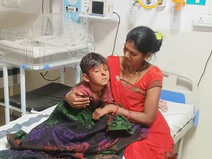 Stray dog attack: Six-year-old boy playing face notcha, admitted to district hospital