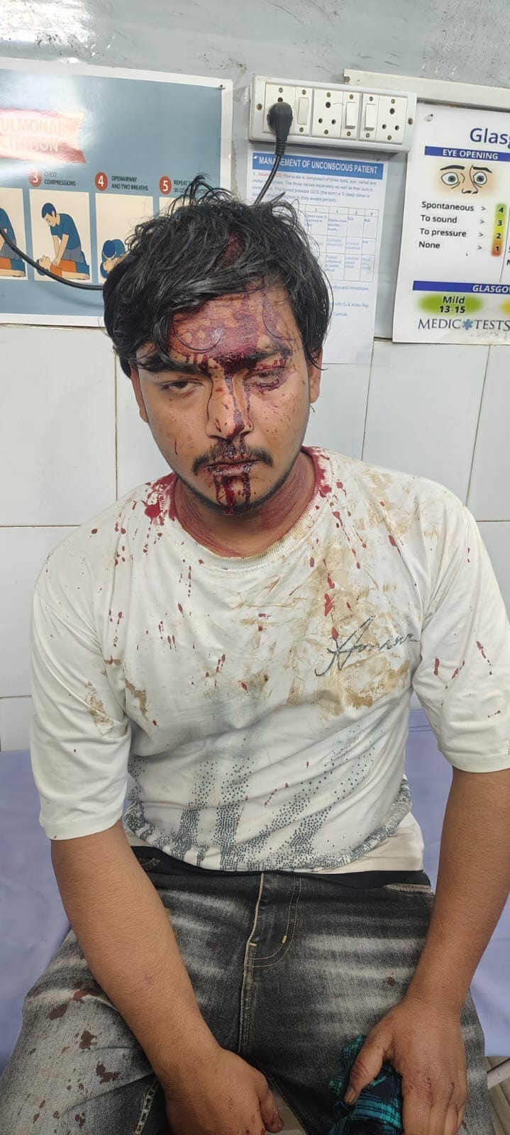 Four injured after bricks and stones were thrown during a birthday party