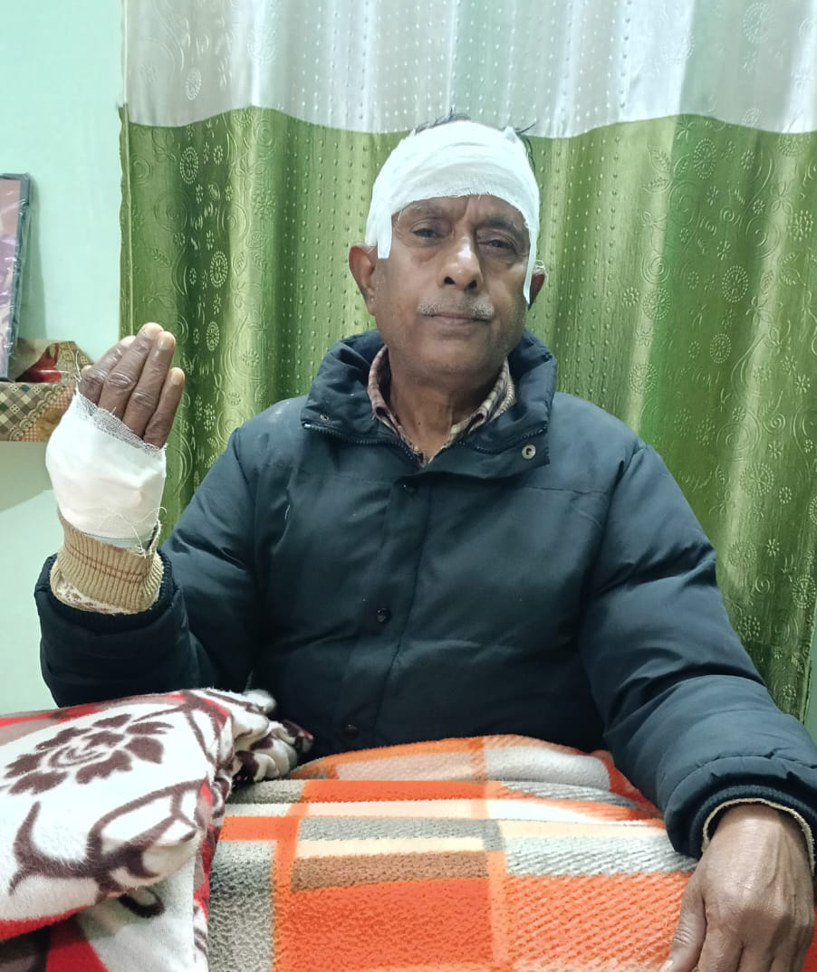 Retired MDA clerk bitten by monkey, required eight stitches