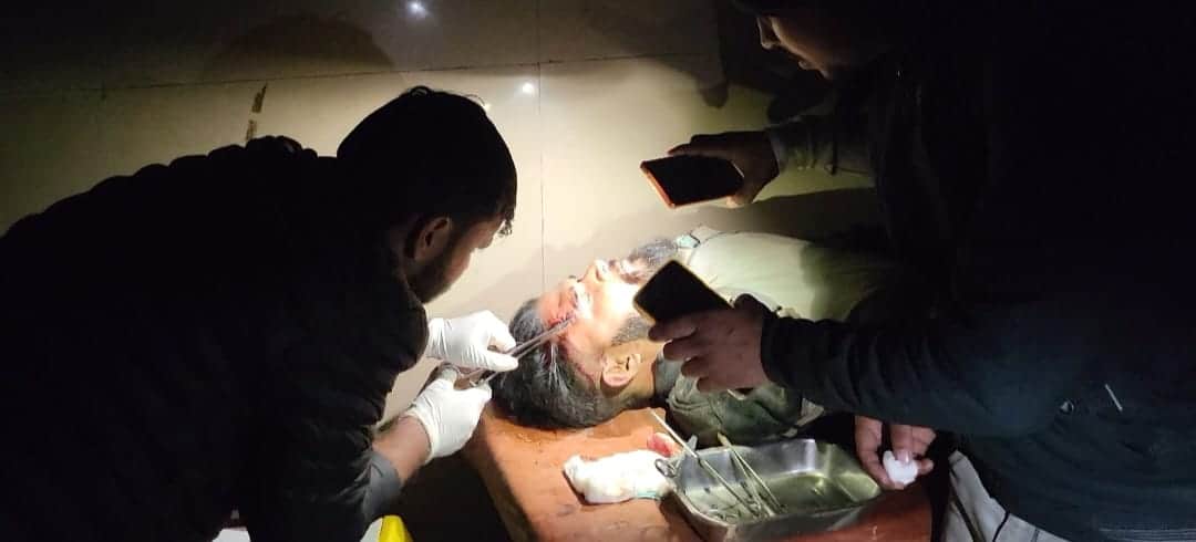 फोटो 17 महाराजा तेज सिंह जिला अस्पताल में मोबाइल की रोशनी में घायल को टांके लगाता स्वास्थ्य कर्