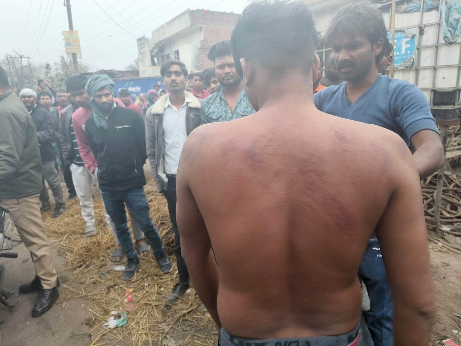 पिटाई में जख्मी कार चालक। 