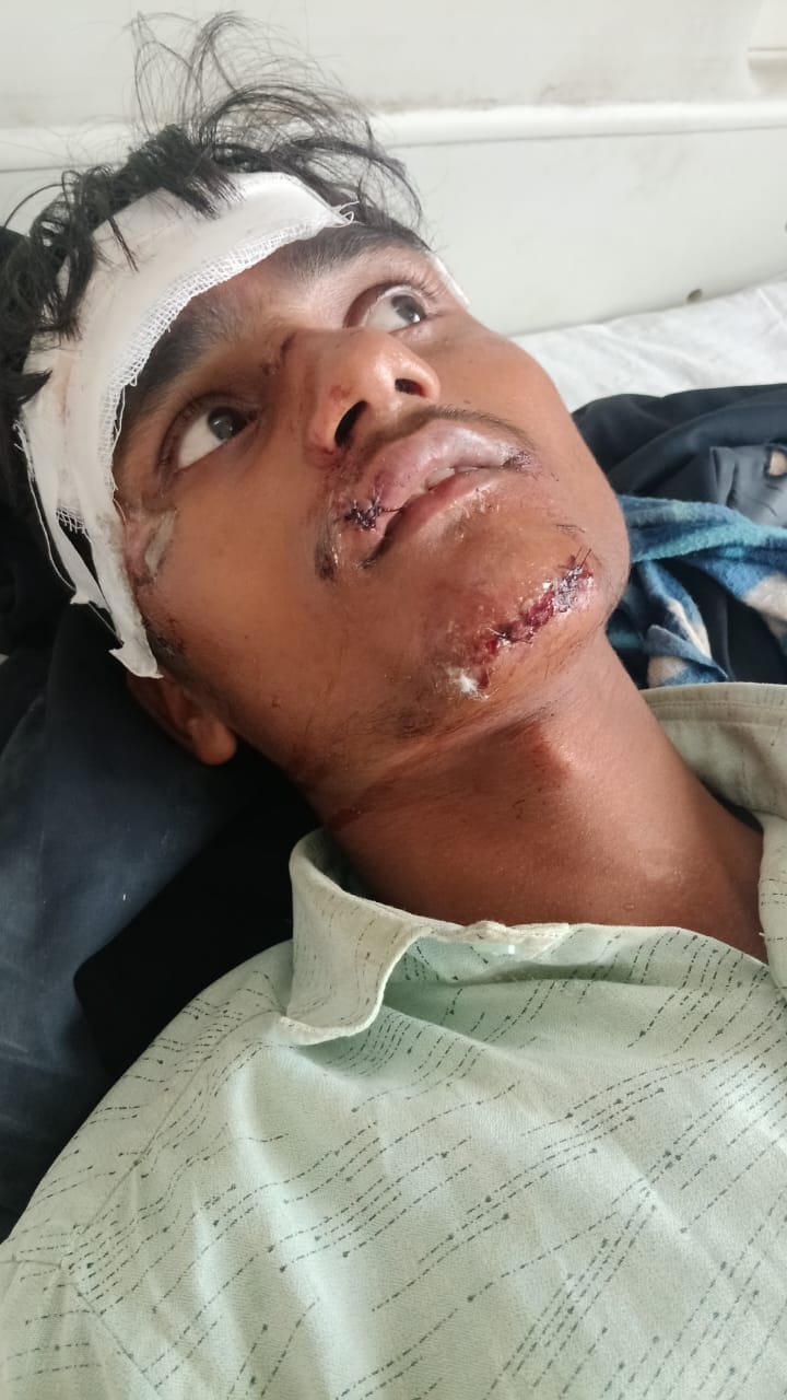 Bike collides with electric pole, two injured