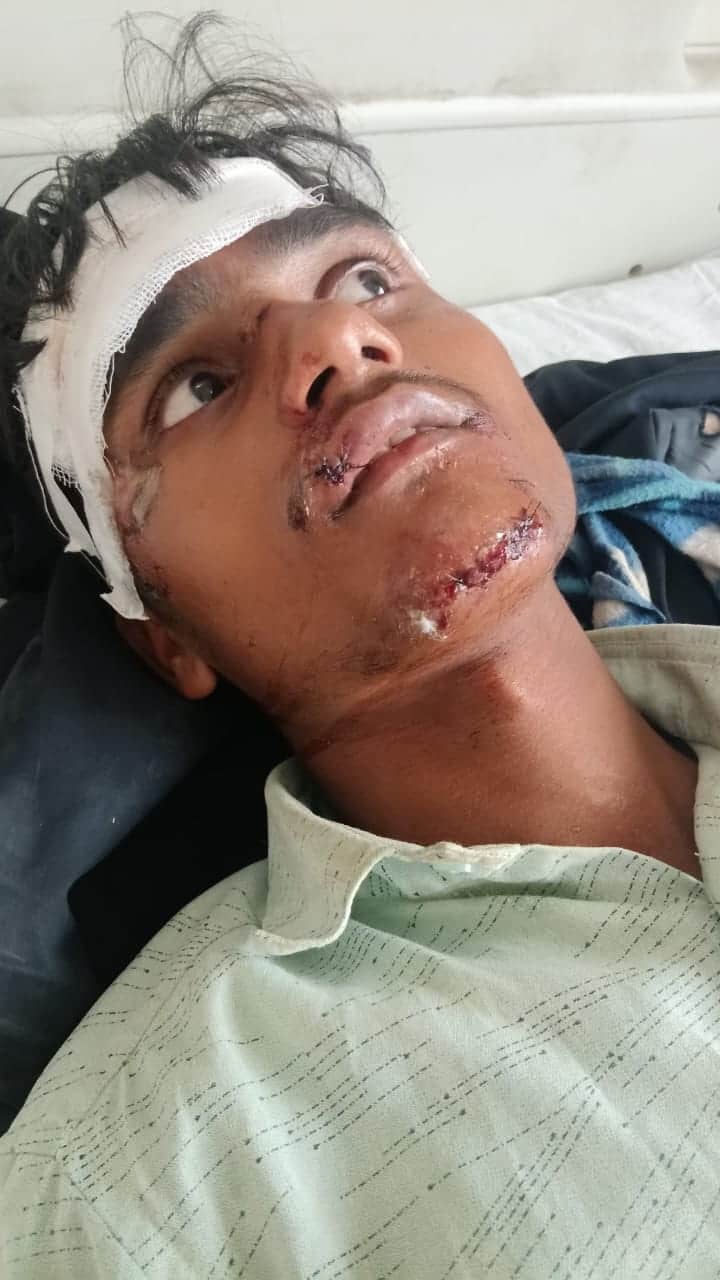 घायल अजय कुशवाहा।