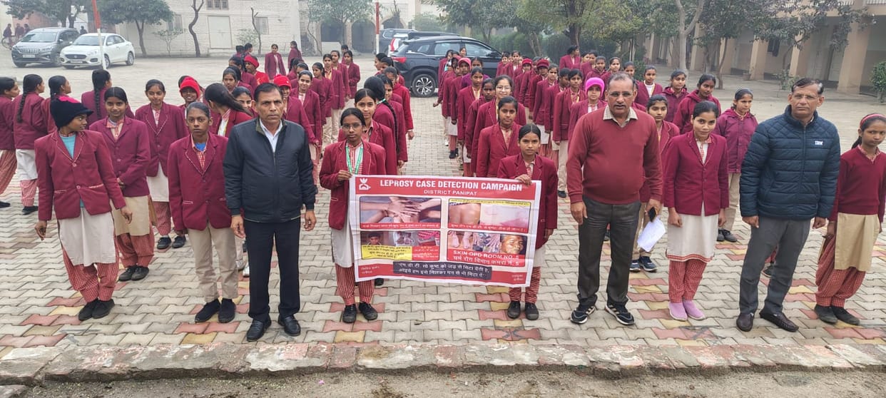 Made girl students aware by running leprosy campaign