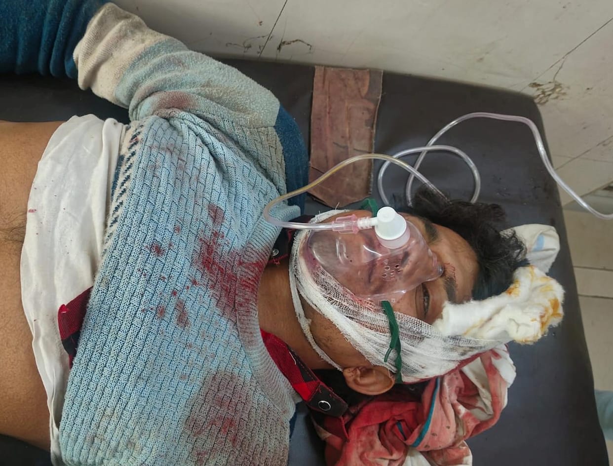 Shuttering of under-construction building collapses, five workers injured
