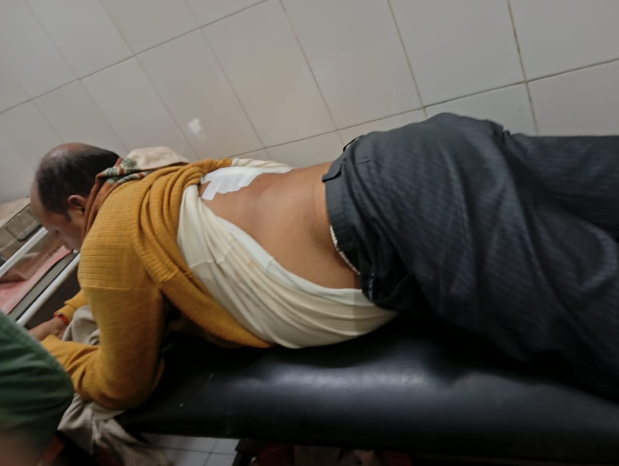BJP leader shot by miscreants, bullet lodged in his back, condition critical in Gorakhpur