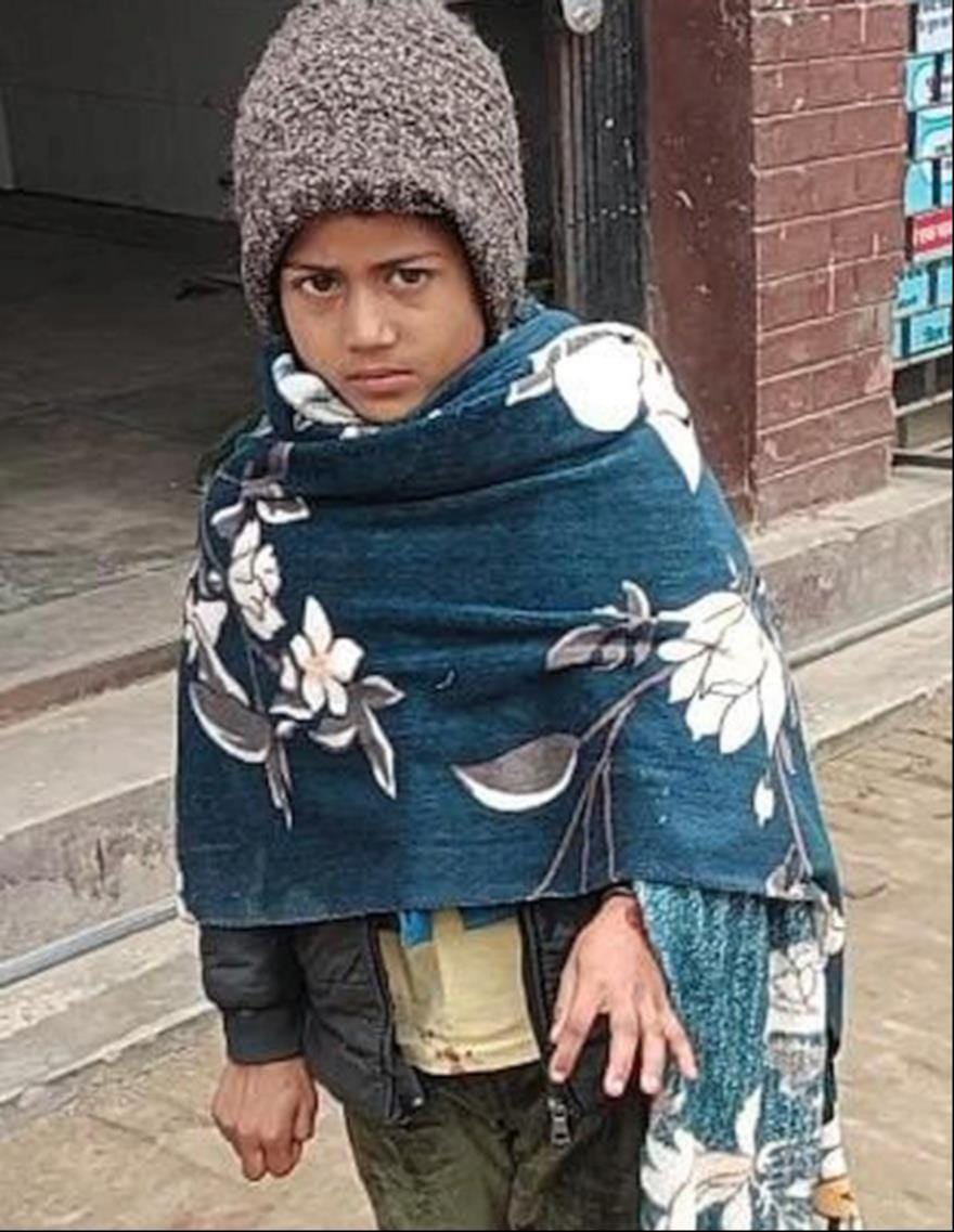 Dog bites and injures innocent child