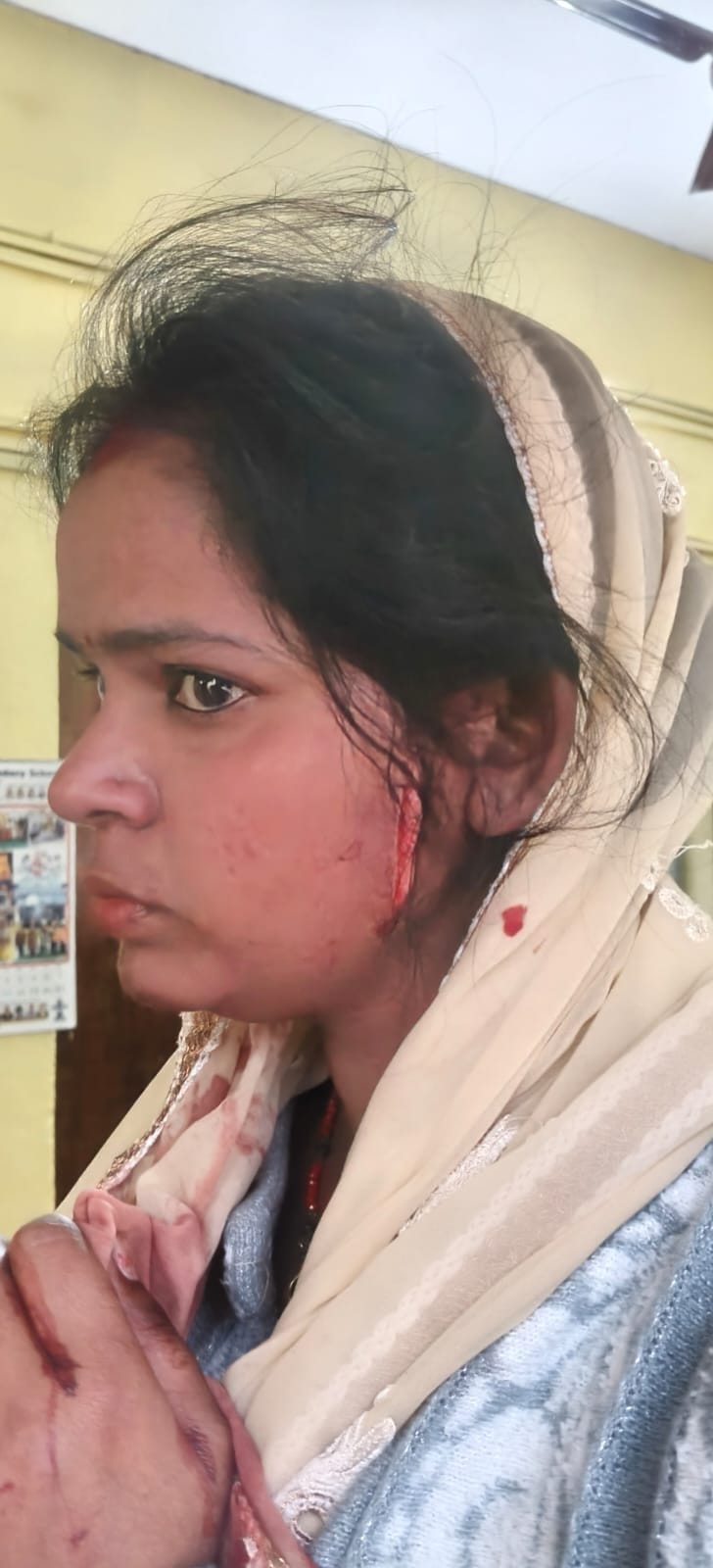 Father, wife and son injured with blade for not giving money for liquor