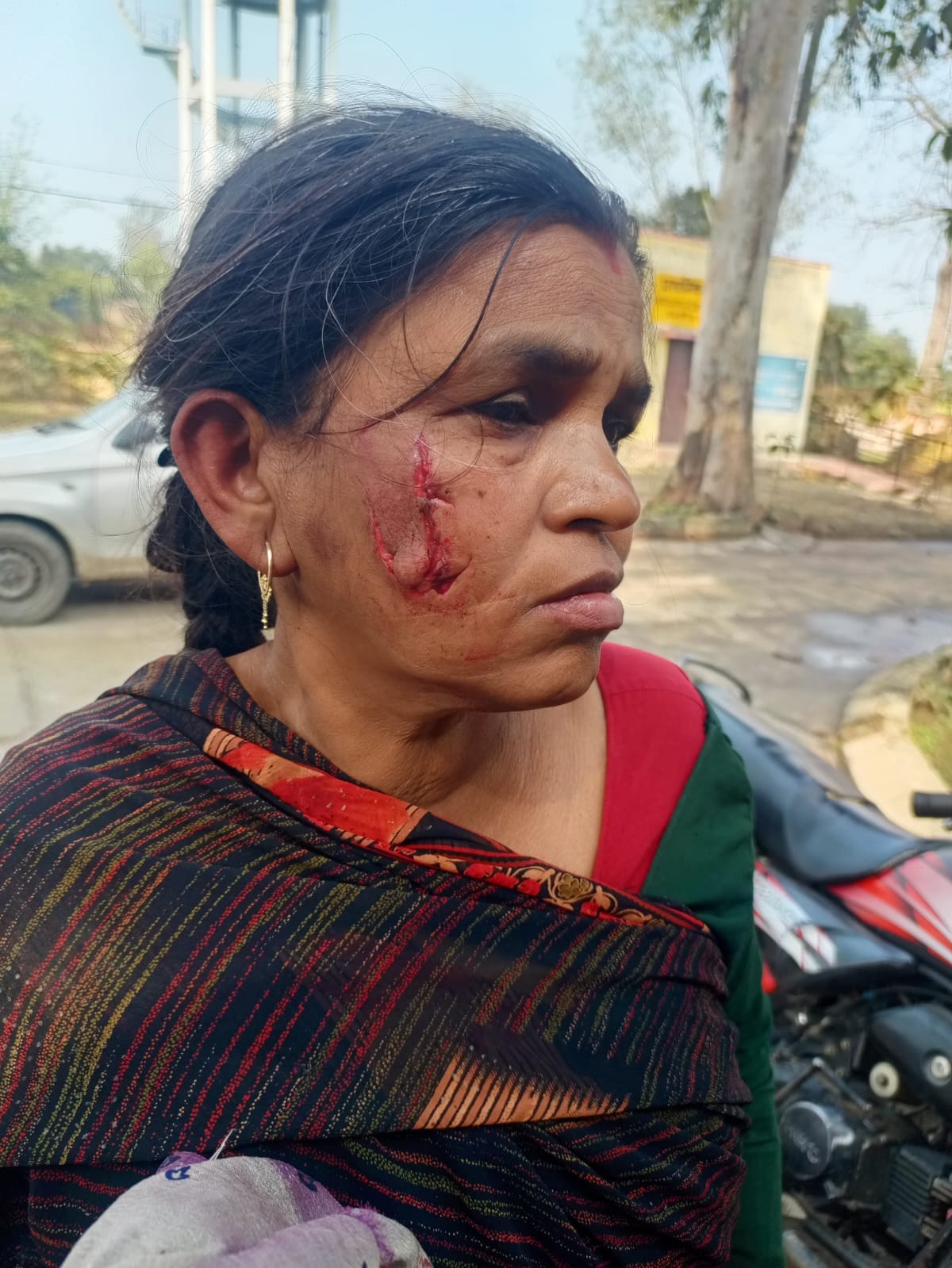 Monkey terror continues in Gajraula, woman injured
