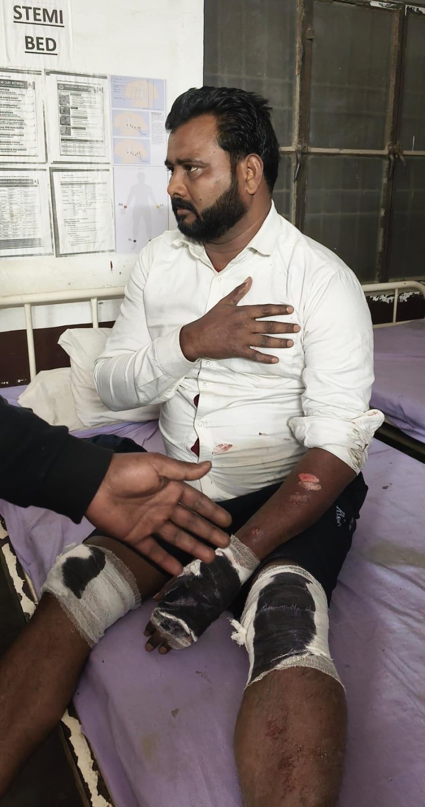 A tempo overturned while trying to save itself from a sudden influx of monkeys, killing a woman and injuring three others