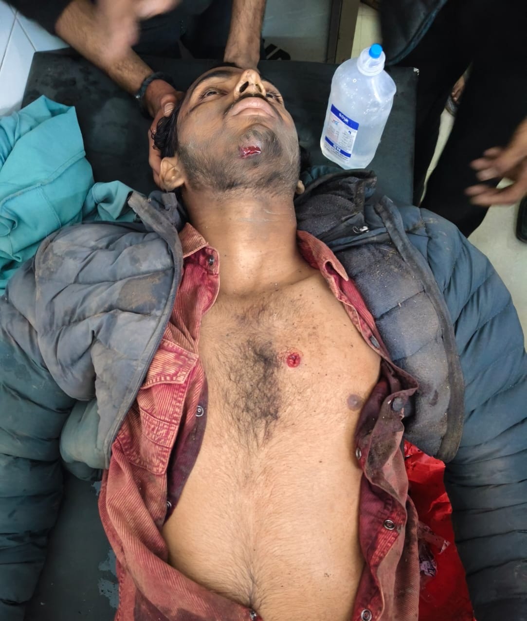 A young man was shot in the chest during a wedding ceremony.