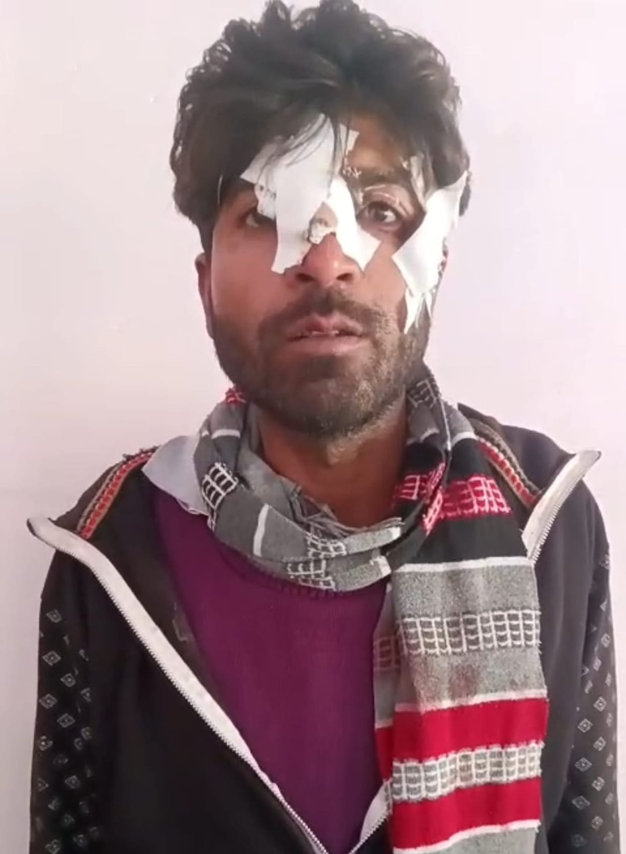 A young man riding a bike was caught in Chinese thread and received five stitches