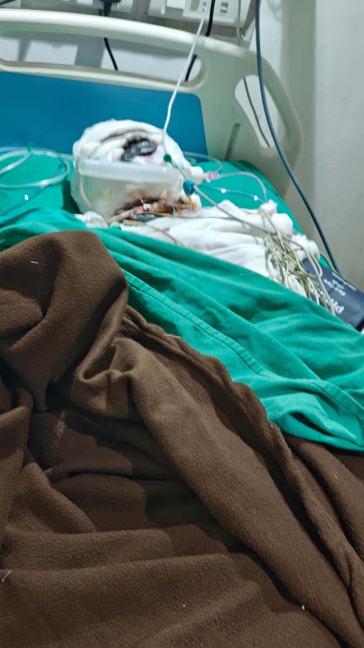 मंगल कार्बन प्लांट में झुलसे दो लोगों की मौत