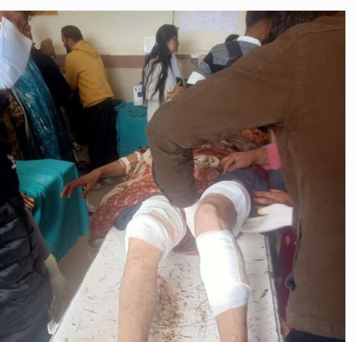 राजोेरी जिले के दरहाल में जंगली सूअर का हमले मे तीन घायफोटो स्रोत संवाद