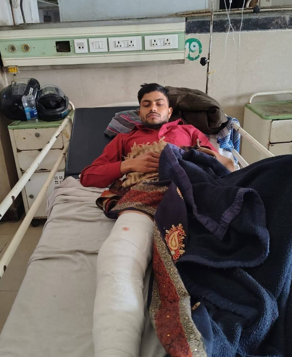Two brothers going to a party were injured in a road accident.