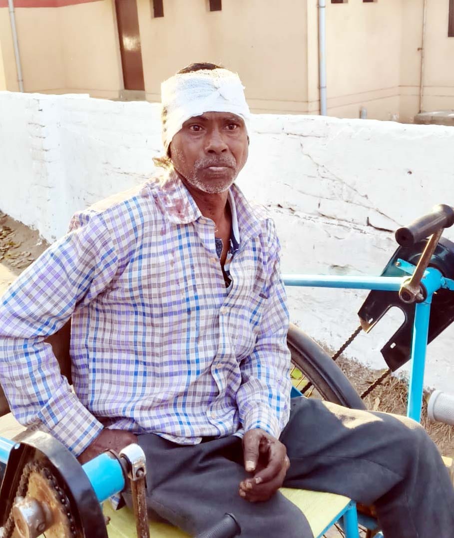 Disabled laborer injured after being attacked with a sickle