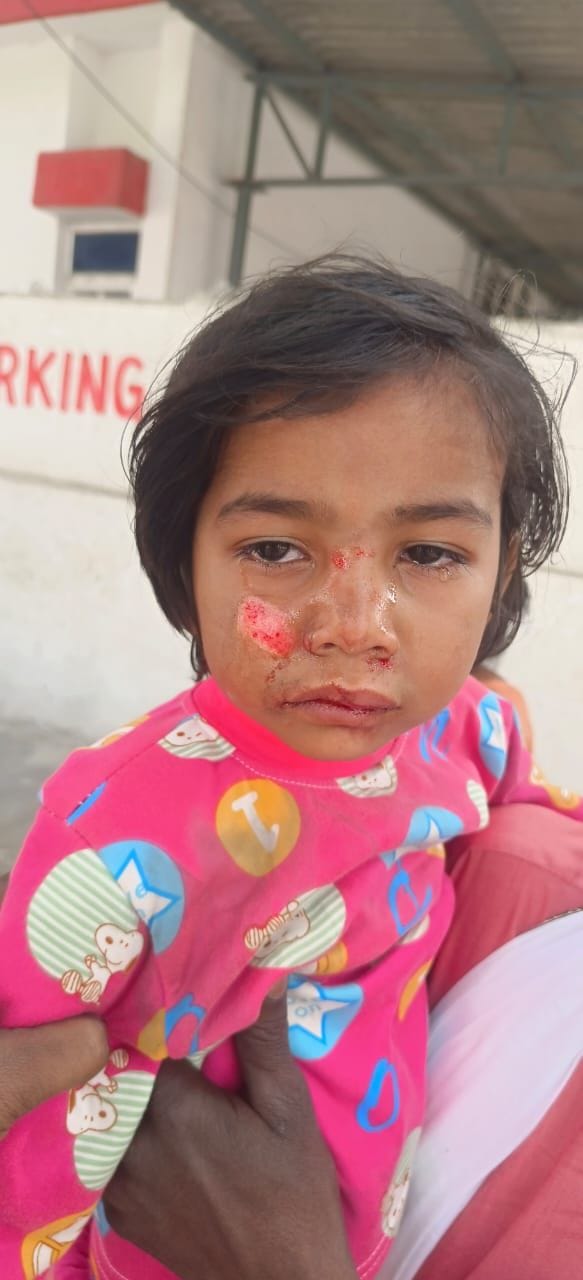 Couple and children beaten up over minor bike collision