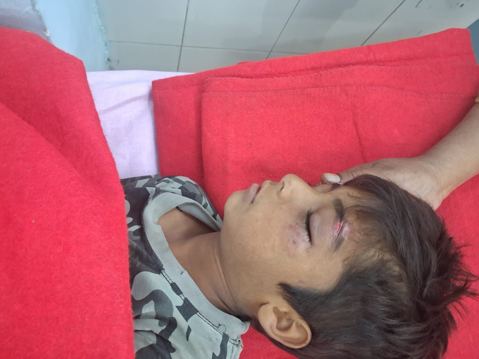 Child injured in car collision on Ganga Canal bridge