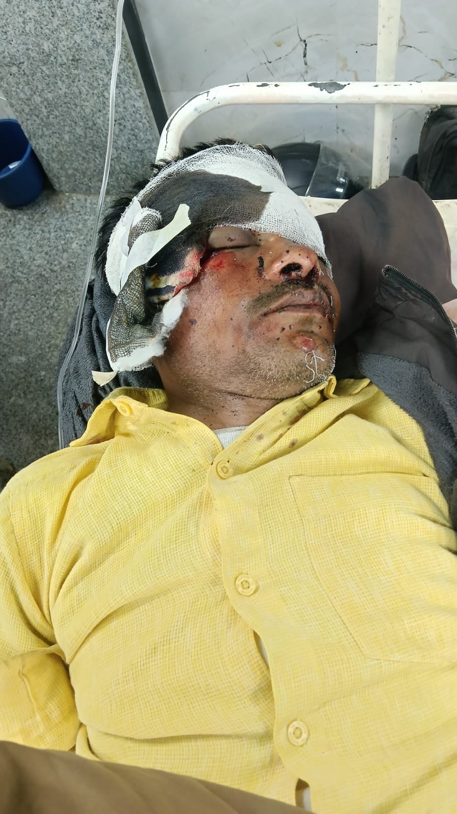 Two injured after colliding with a bike coming from the opposite direction