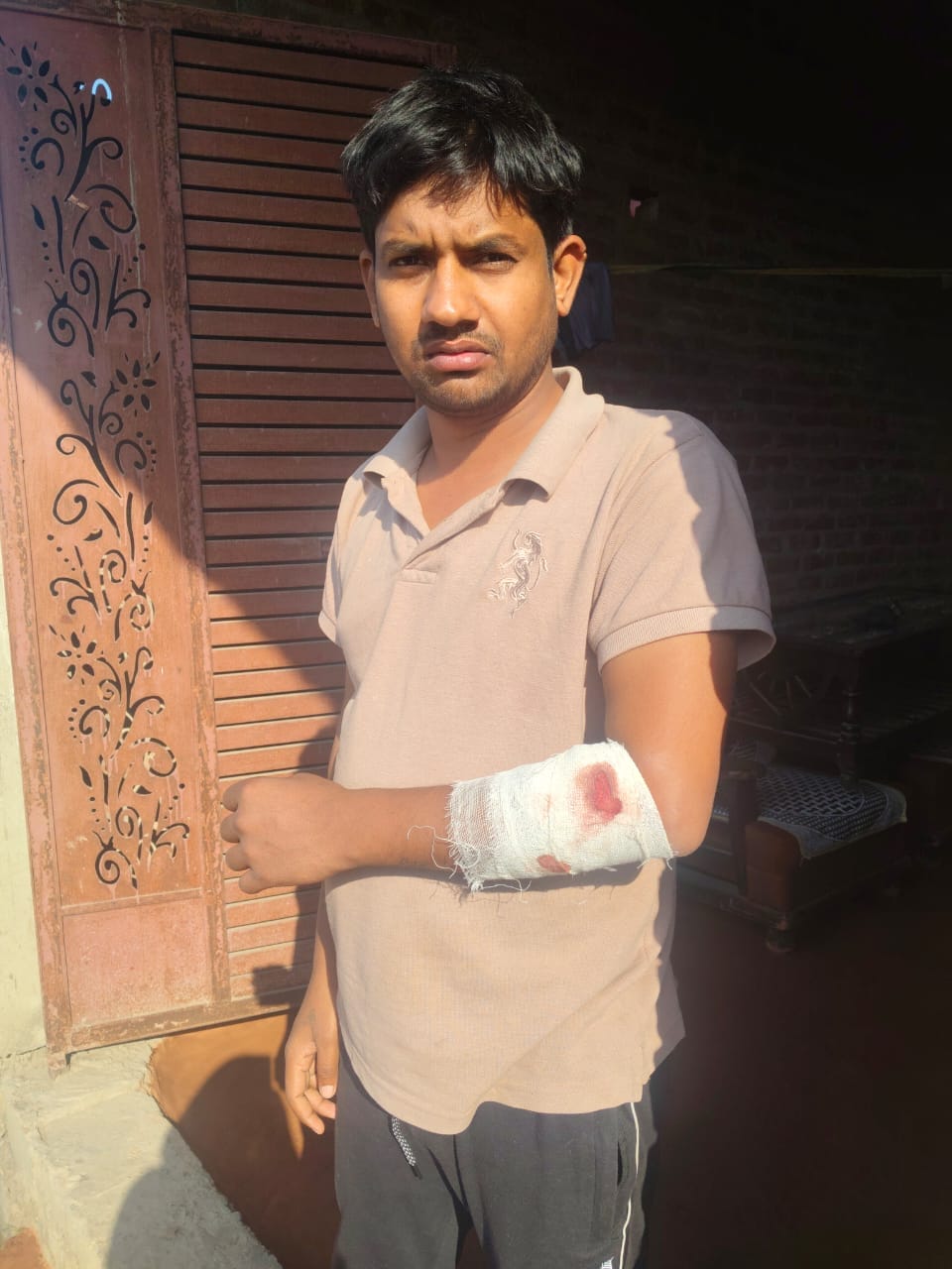In Samayan village, a dog mauled three people, including an innocent child.