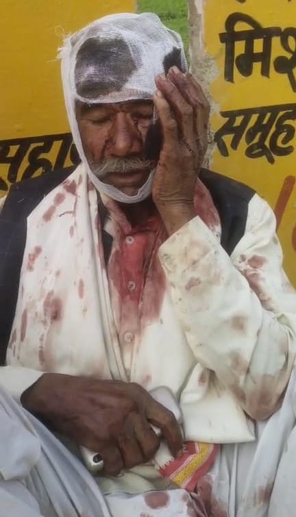 The car overturned after colliding with Scorpio and Thar, then shot dead