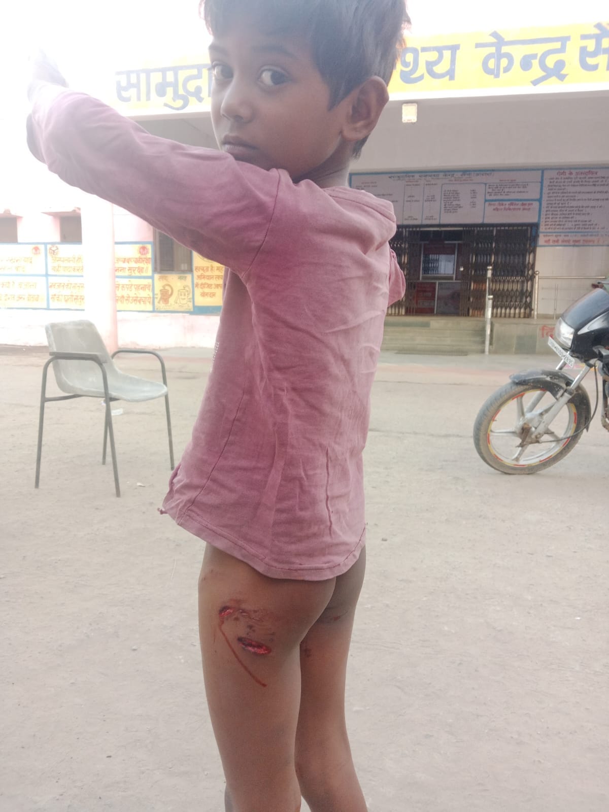 Six-year-old boy attacked by dog