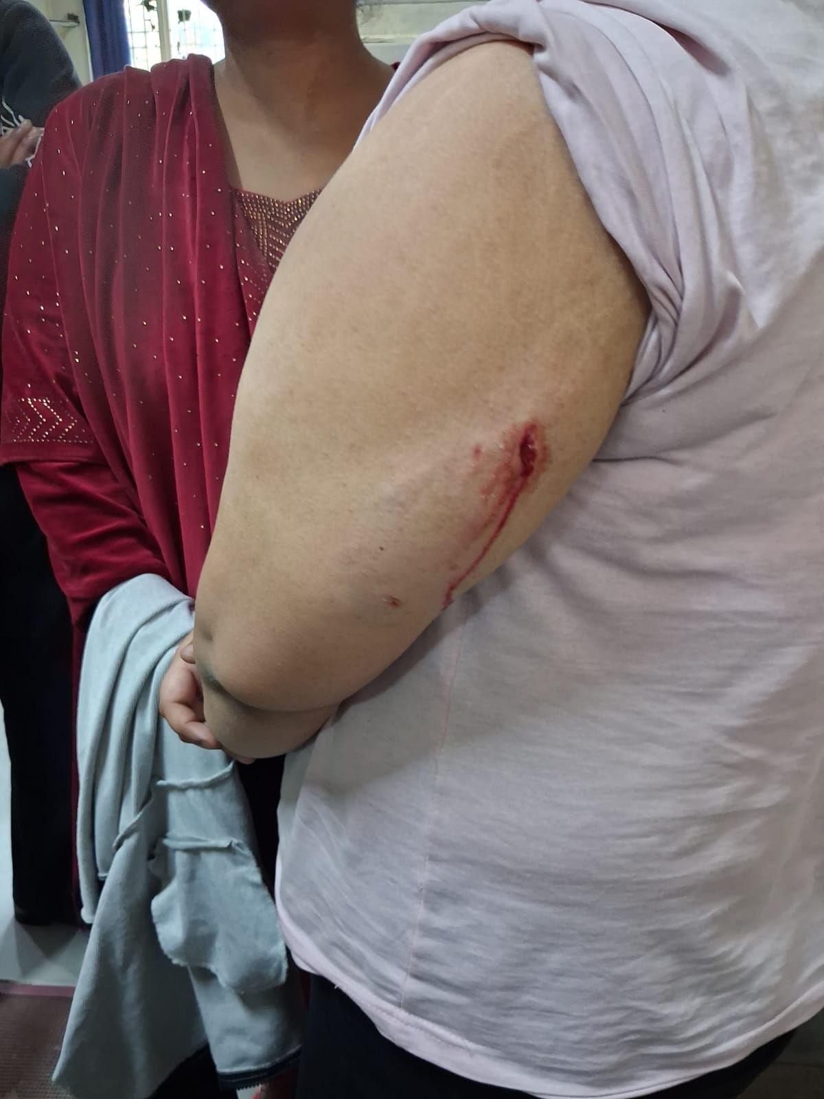 German Shepherd bites woman standing outside shop, FIR filed against owner