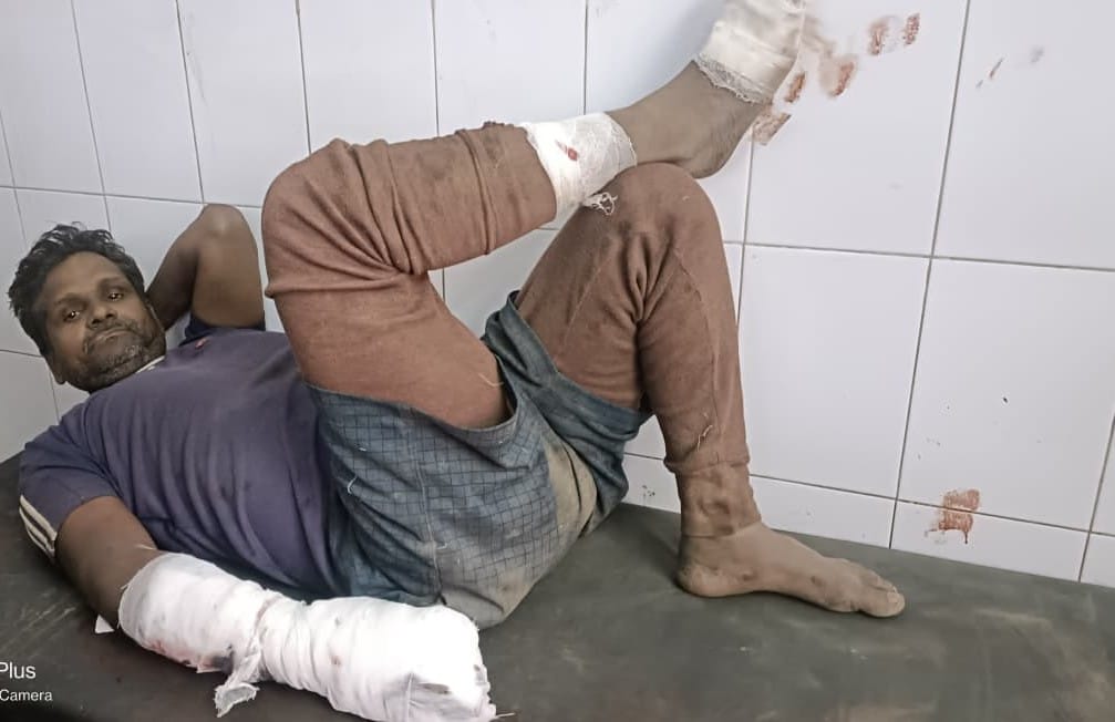 Air filling machine tank bursts, woman dies, husband critical