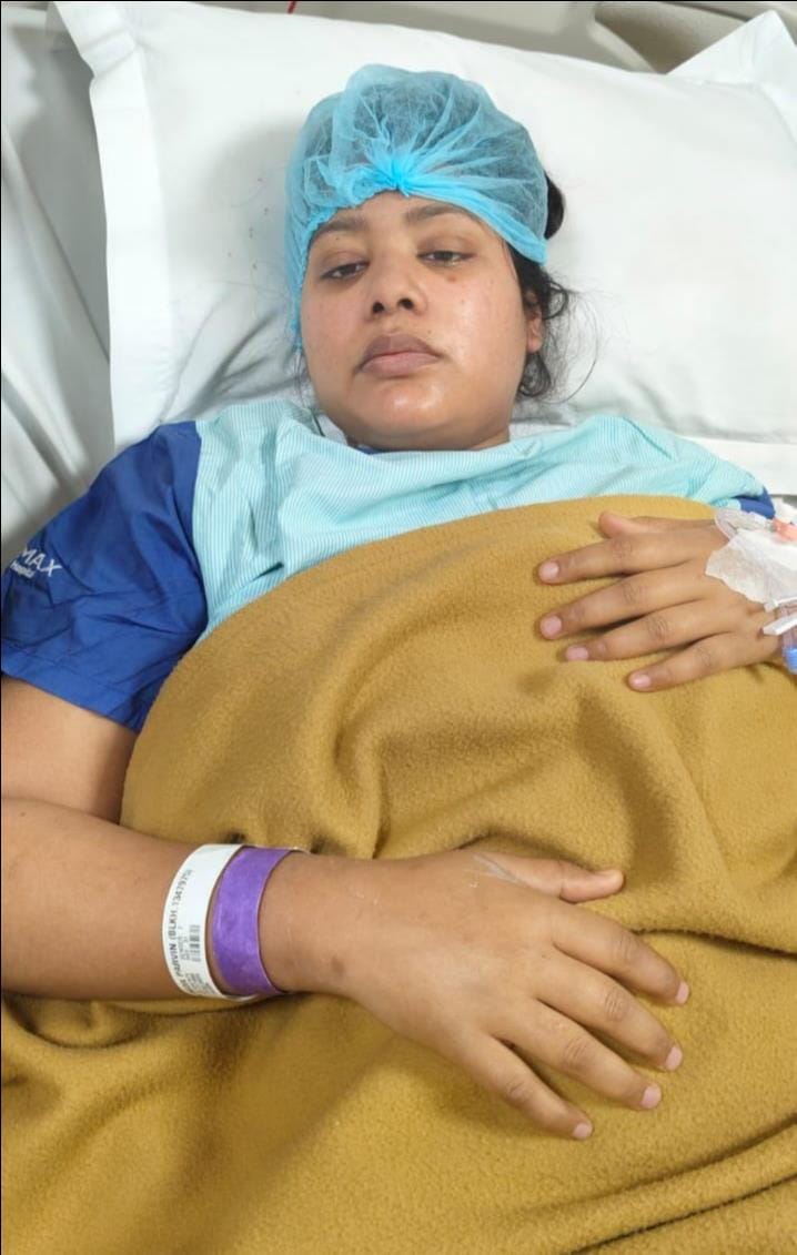 Daughter-in-law underwent liver transplant to save brother-in-law's life