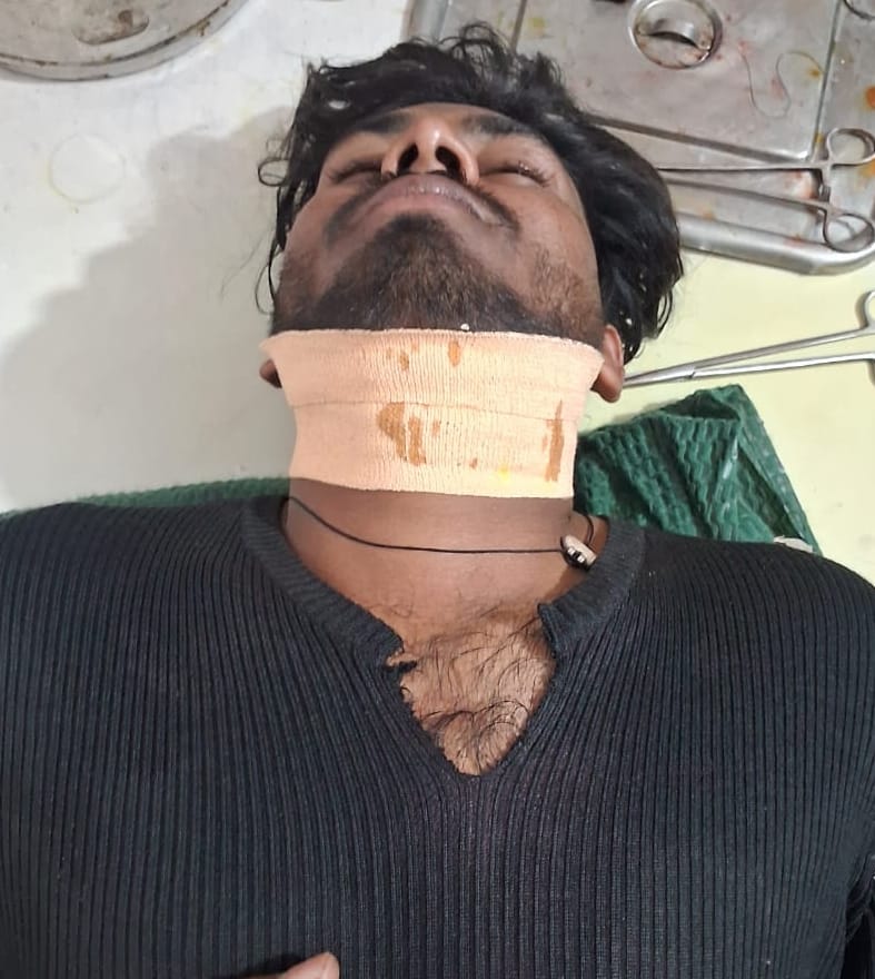 Brothers enter home and slit sister's lover's throat, condition critical