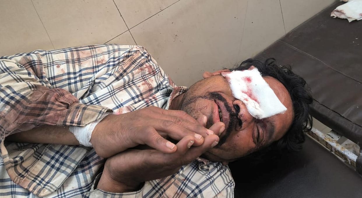 Young man attacked with scissors in the eye, condition critical