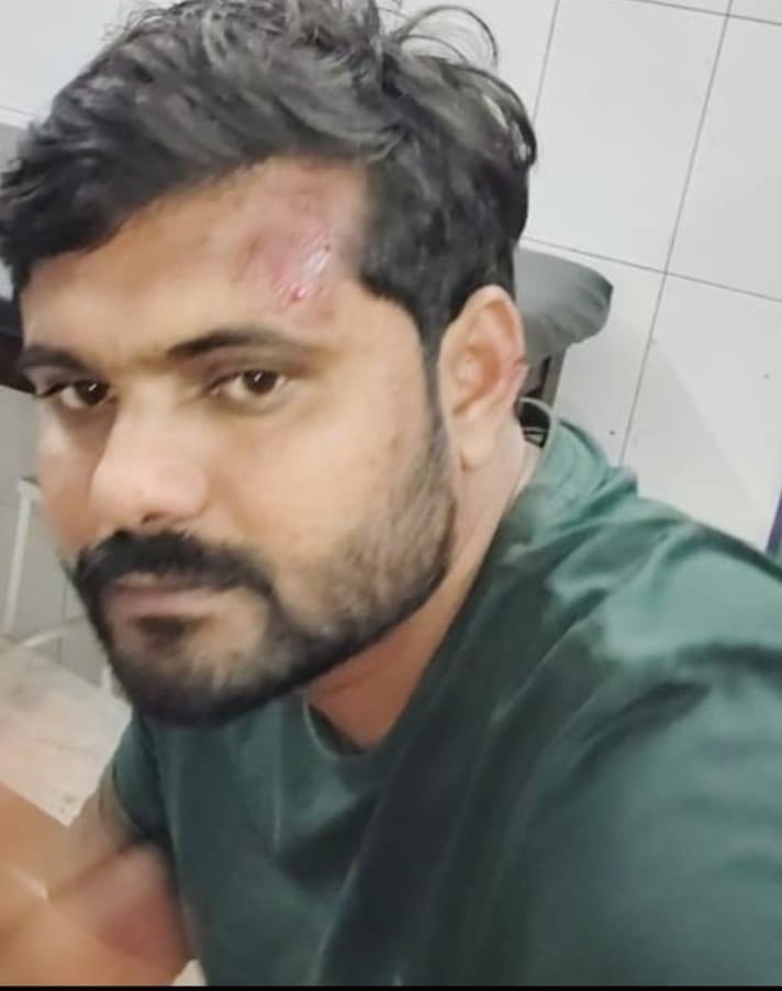 Four people in the car were beaten and injured after hitting the side.
