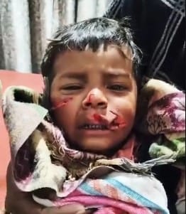 Dogs are becoming increasingly dangerous, killing five people in two days, and an innocent child received 50 stitches on his face.