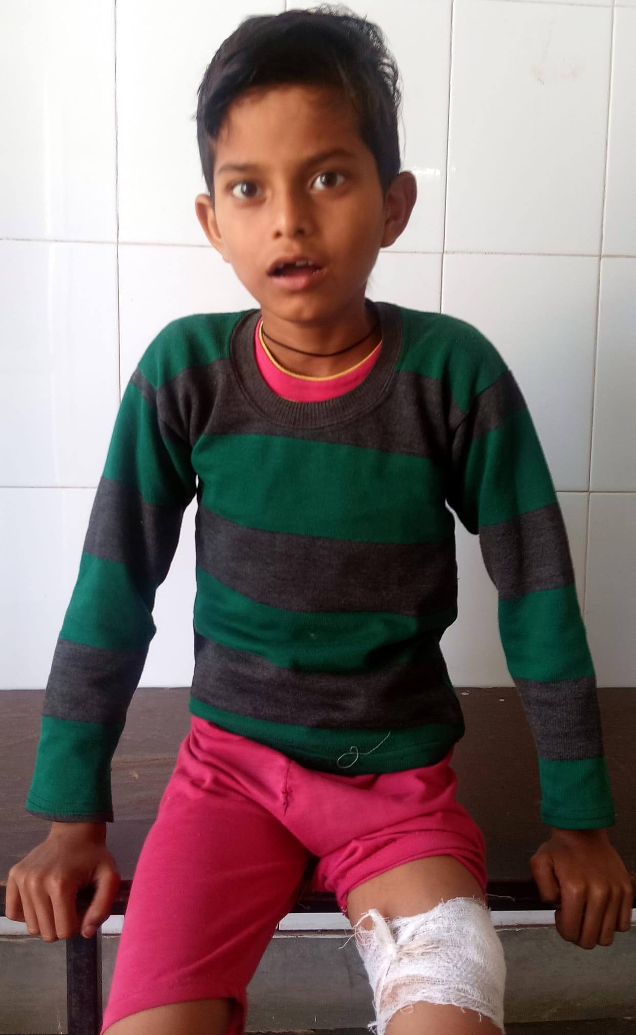 Monkey attacks boy trying to save his friend