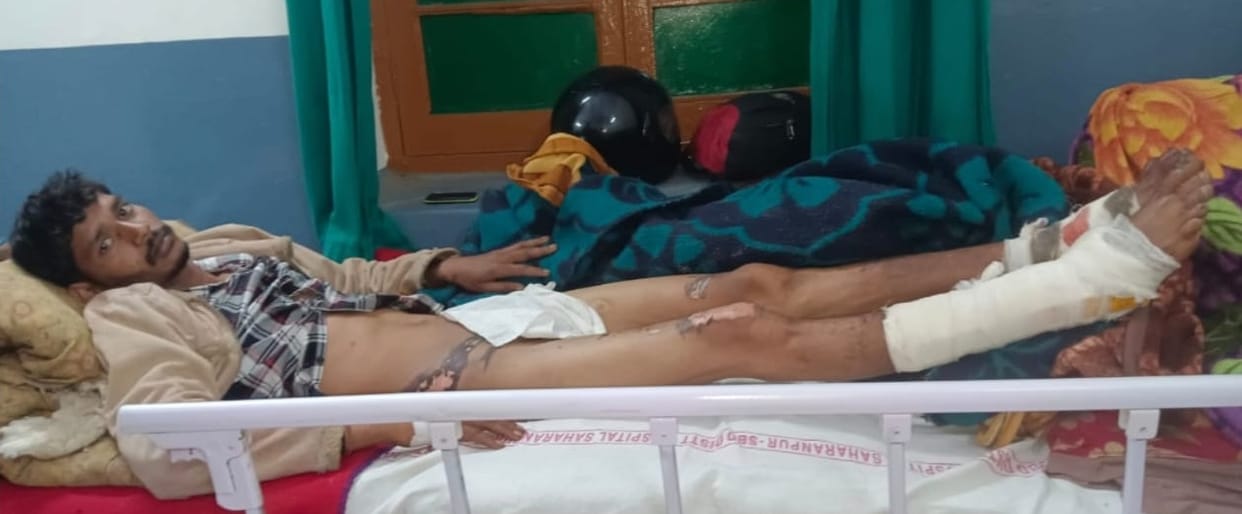 Two youths came in contact with live wire in the field, one seriously injured