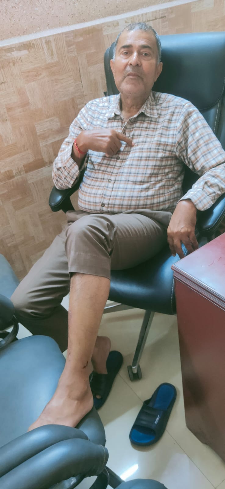 The association head who was out for a walk was bitten by a dog