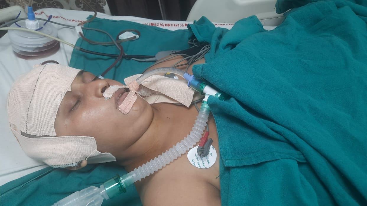 A woman drying clothes was attacked by a monkey, suffering a head fracture after falling onto the roof.