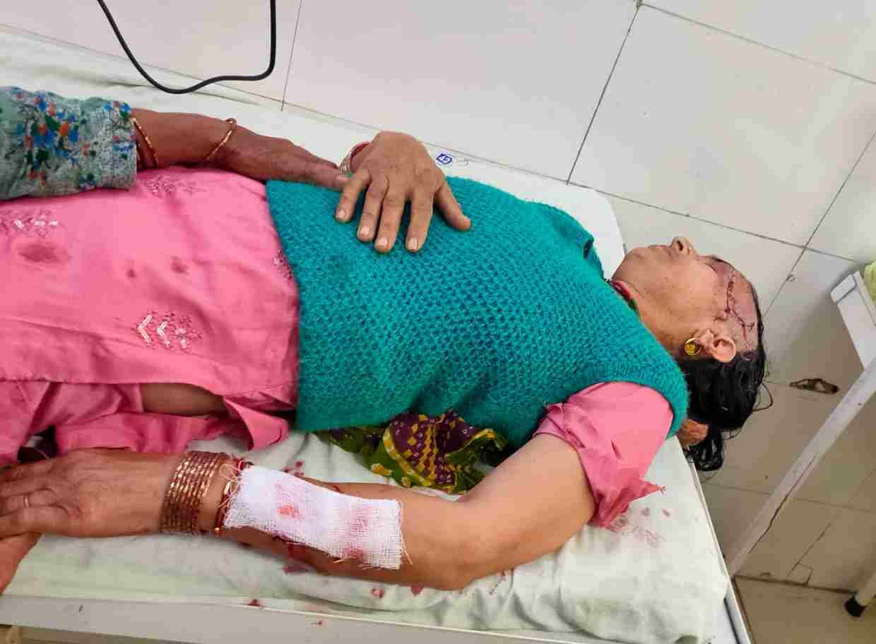 Pitbull attacked the owner, received 8 stitches, incident in Jugaln village